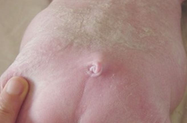 pinodinal