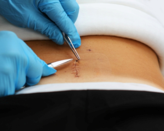 back-surgery