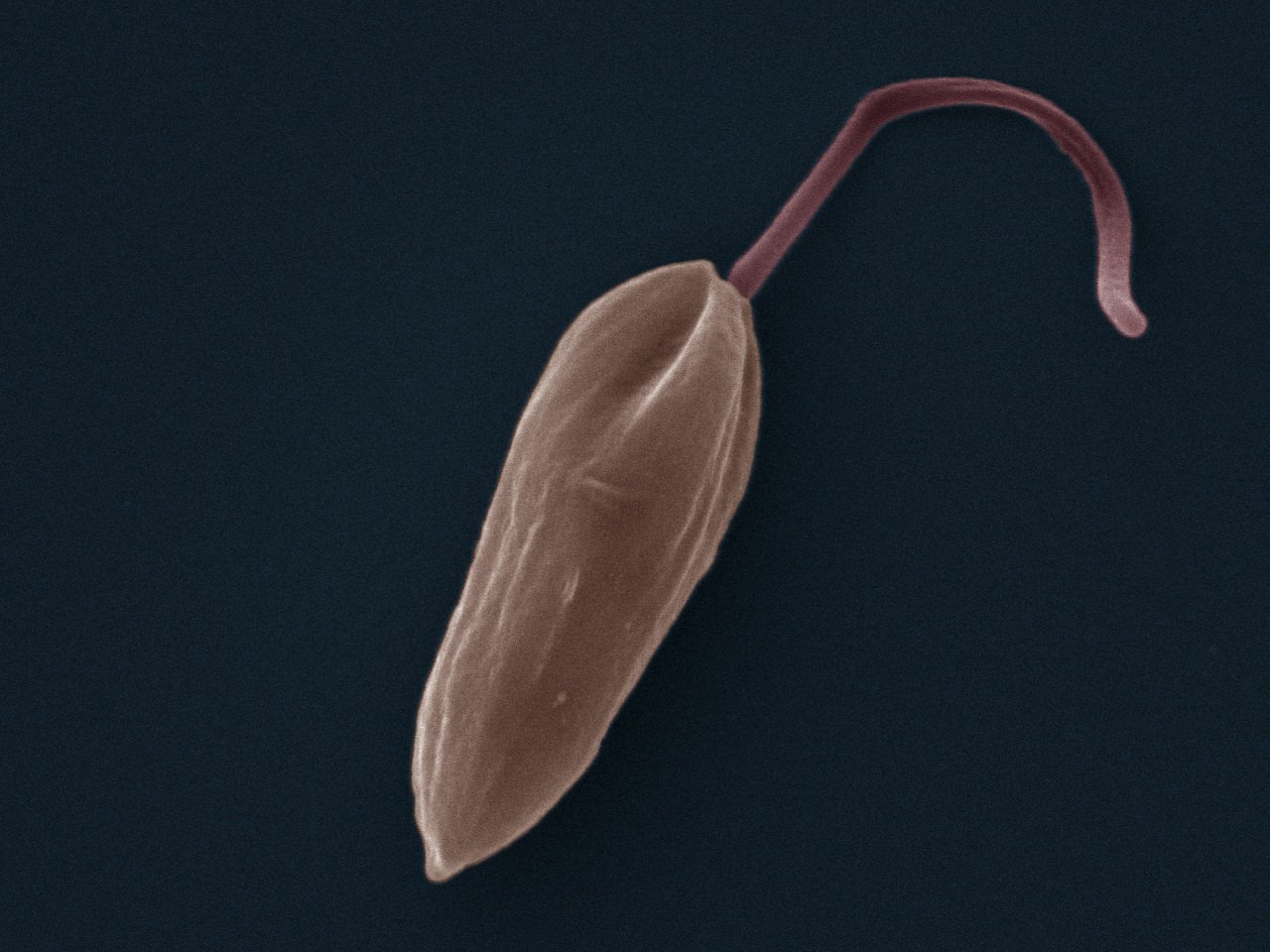 παράσιτο Leishmania mexicana